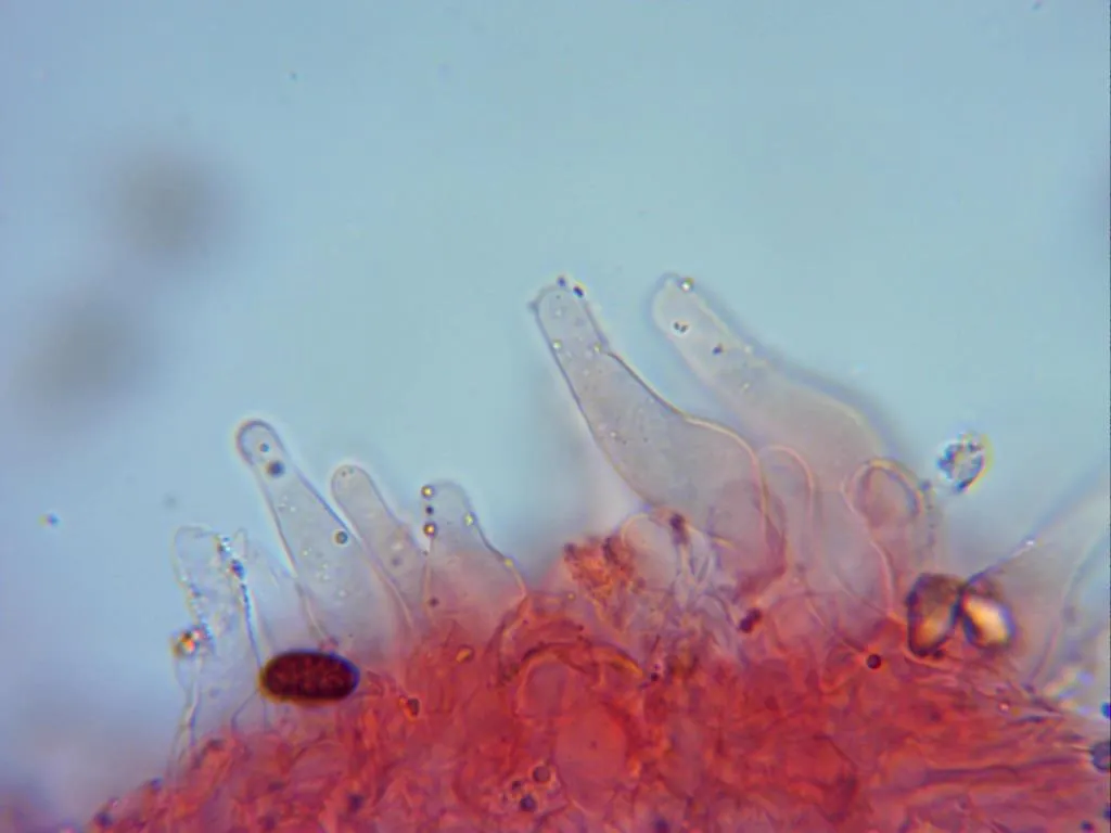 Microscopía de Psathyrella microrhiza - 10 - Cistidios 3